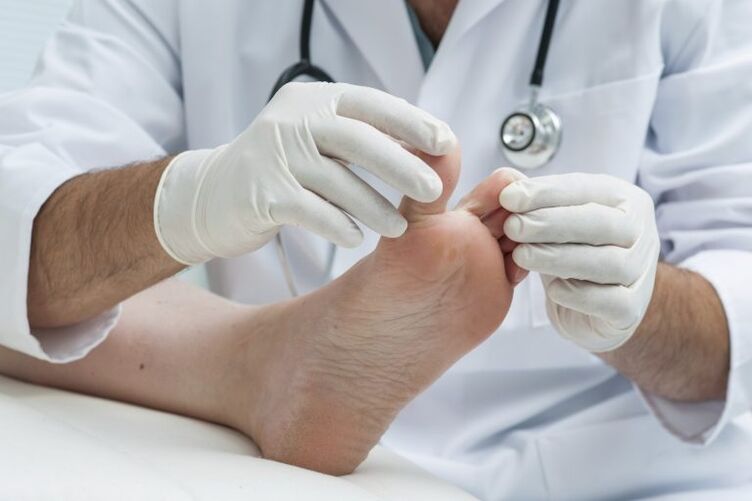Examinarea medicului prin prezența micozei