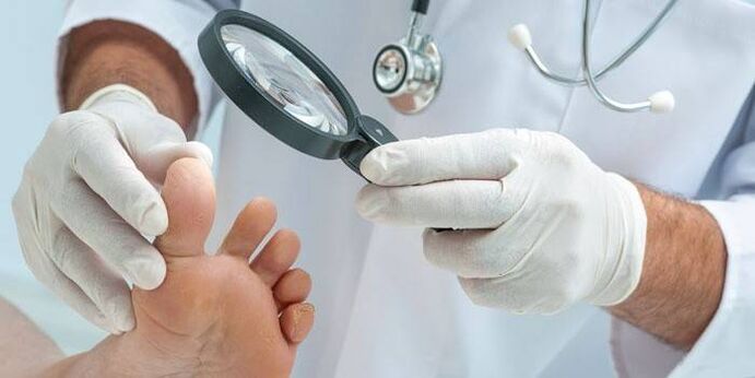 medicul examinează picioarele pentru ciuperci între degete